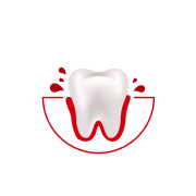 How often do you experience bleeding while brushing or flossing?