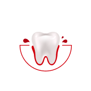 How often do you experience bleeding while brushing or flossing?