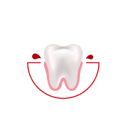 How often do you experience bleeding while brushing or flossing?